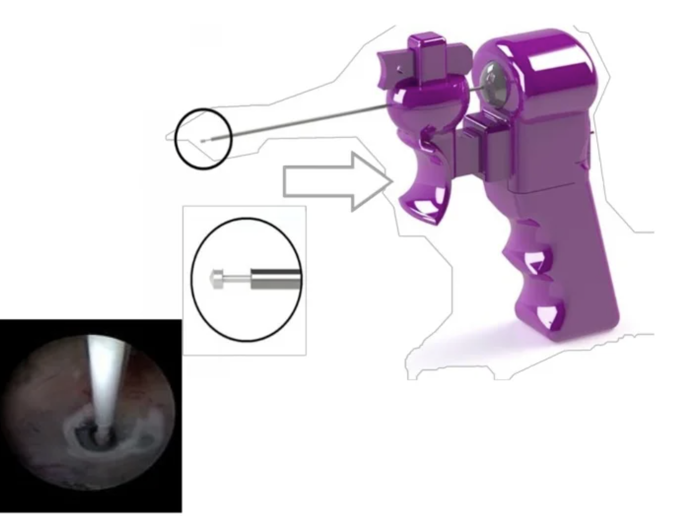 Bisturi elettrico monopolare Toscana Open Research